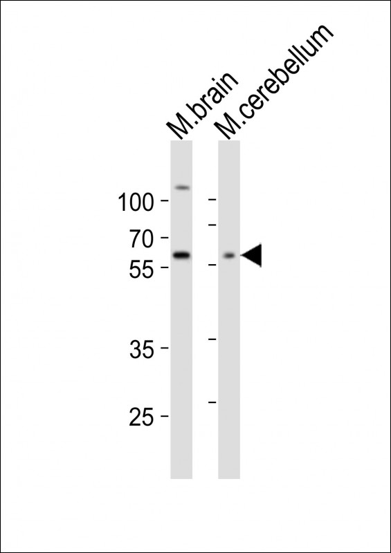 WB - GLD2 Antibody (N-term) AP5092a